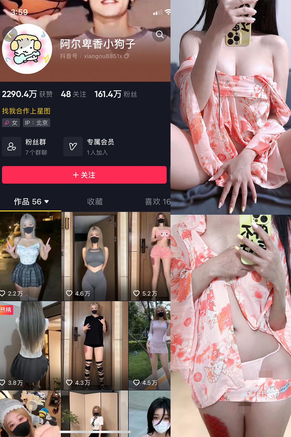 抖音 阿尔卑香小狗子 微密圈 NO.052期 【22P4V】