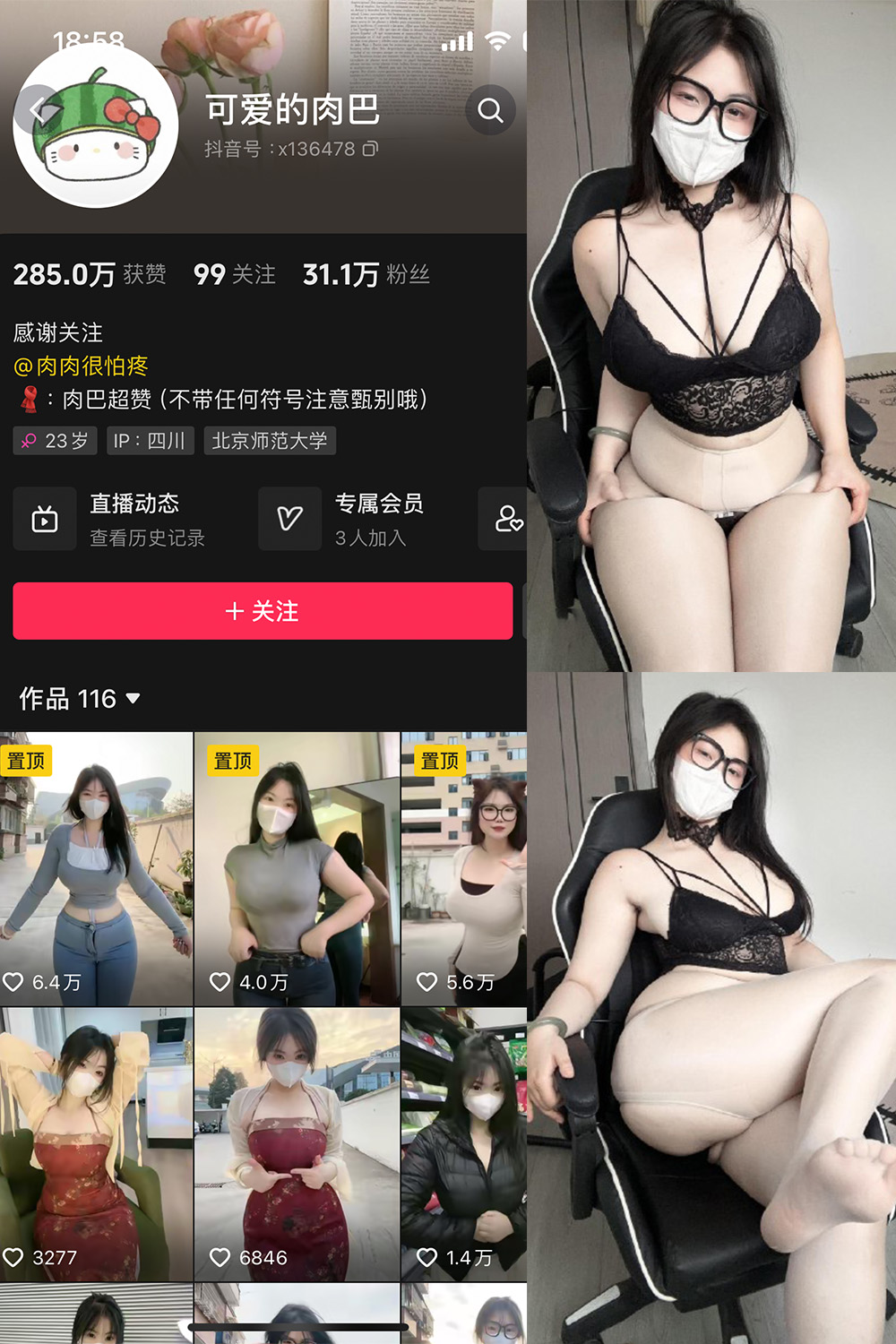 抖音 可爱的肉巴 微密圈 NO.022期 【25V】