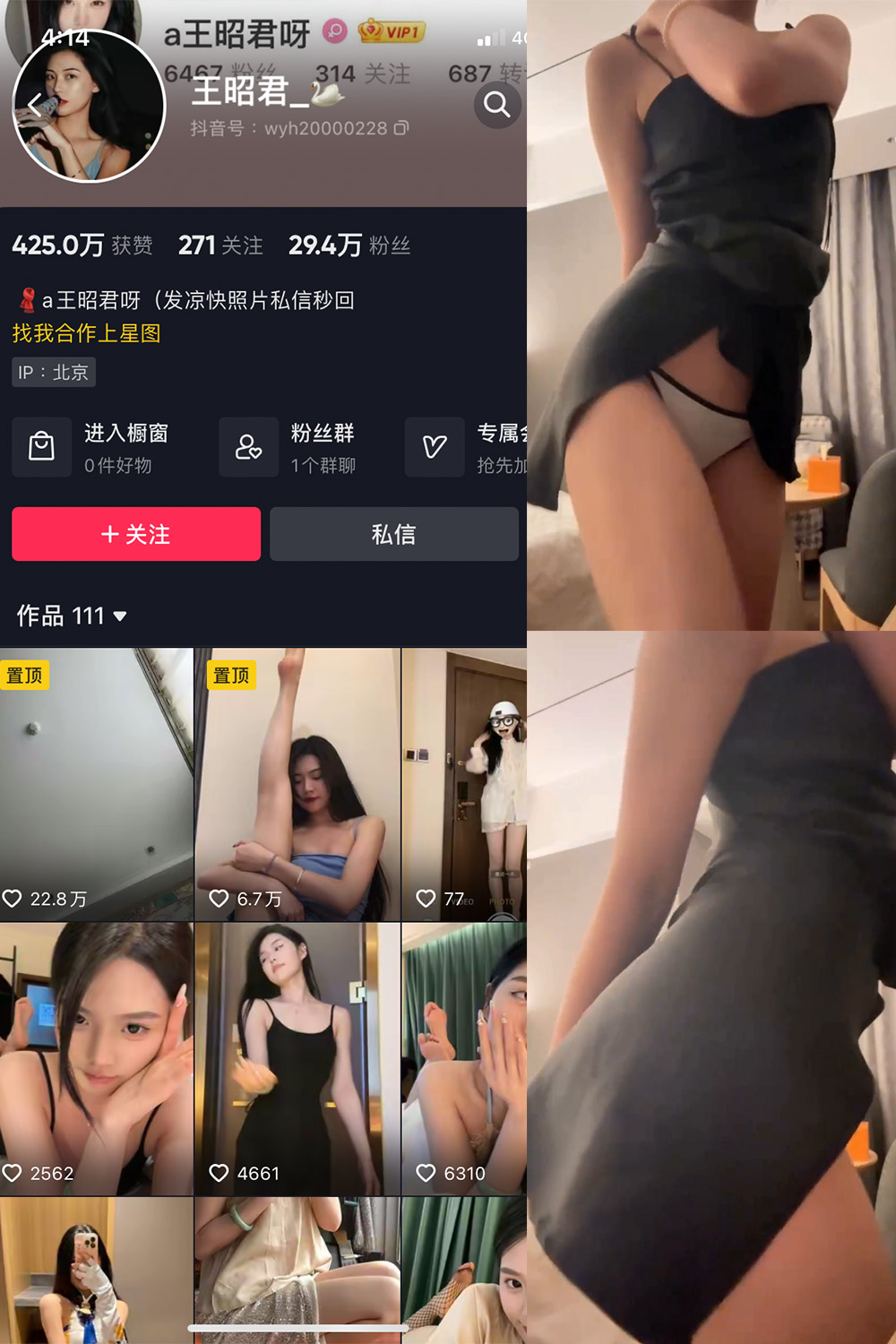 抖音 王昭君 微密圈 NO.010期 【11P1V】