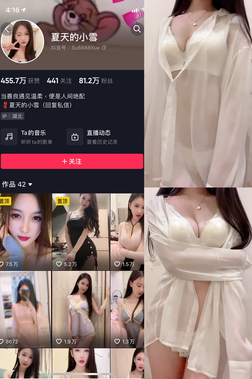 抖音 夏天的小雪 微密圈合集 嘉宾专享 NO.001-011期