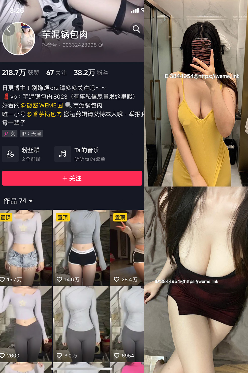 抖音 芋泥锅包肉 微密圈 NO.008期 【11P1V】