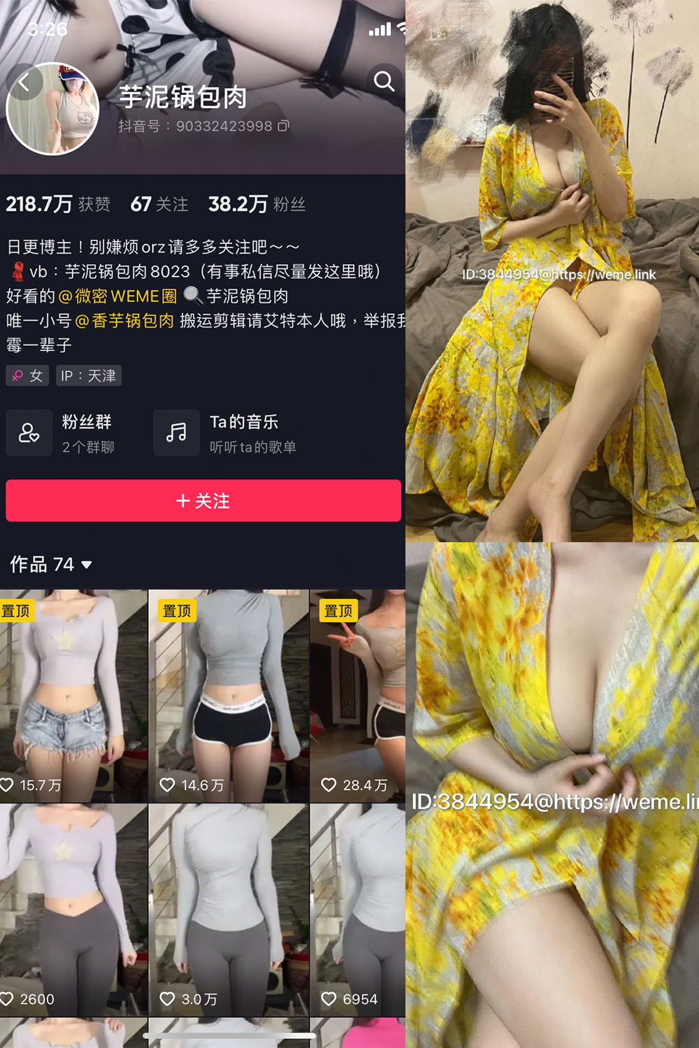 抖音 芋泥锅包肉 微密圈 NO.010期 【4P】