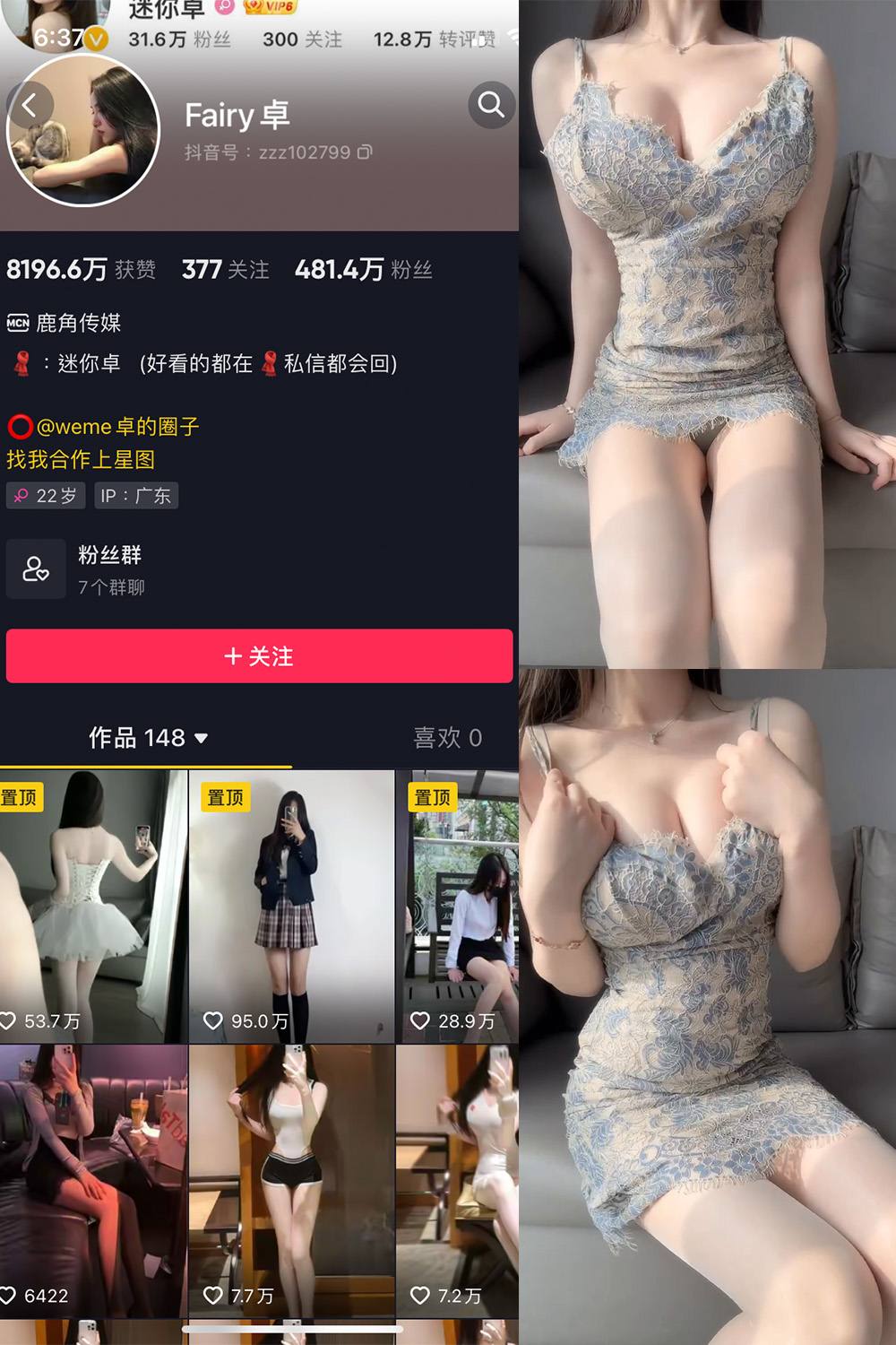 抖音 Fairy卓 微密圈 NO.011期 【4P1V】